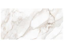 Anatolia 60x120 Majesto Calacatta Oro Rektifiye Vintage